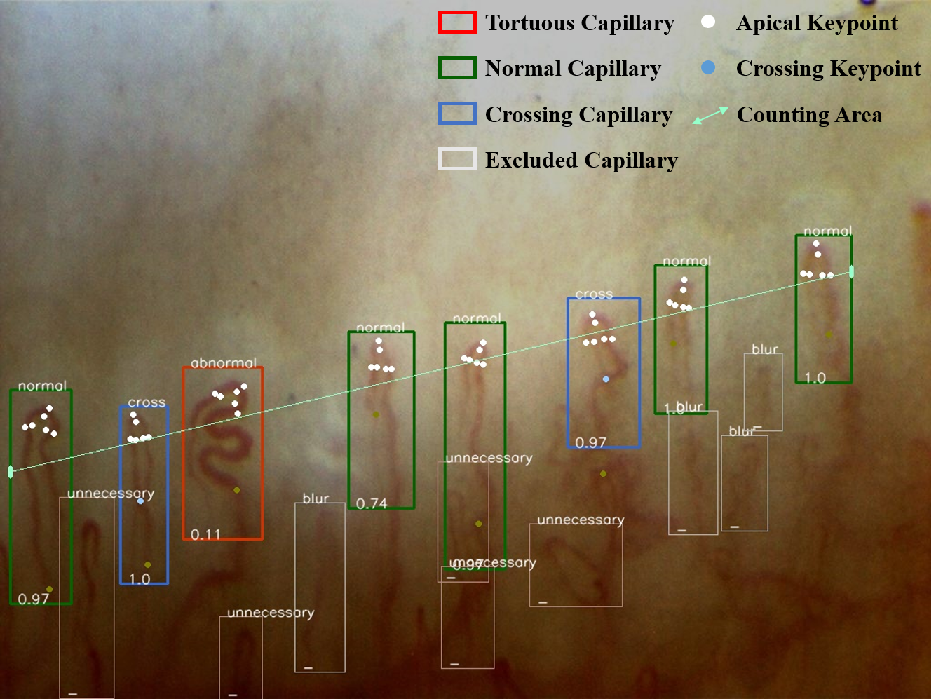 A Comprehensive Dataset and Automated Pipeline for Nailfold Capillary Analysis